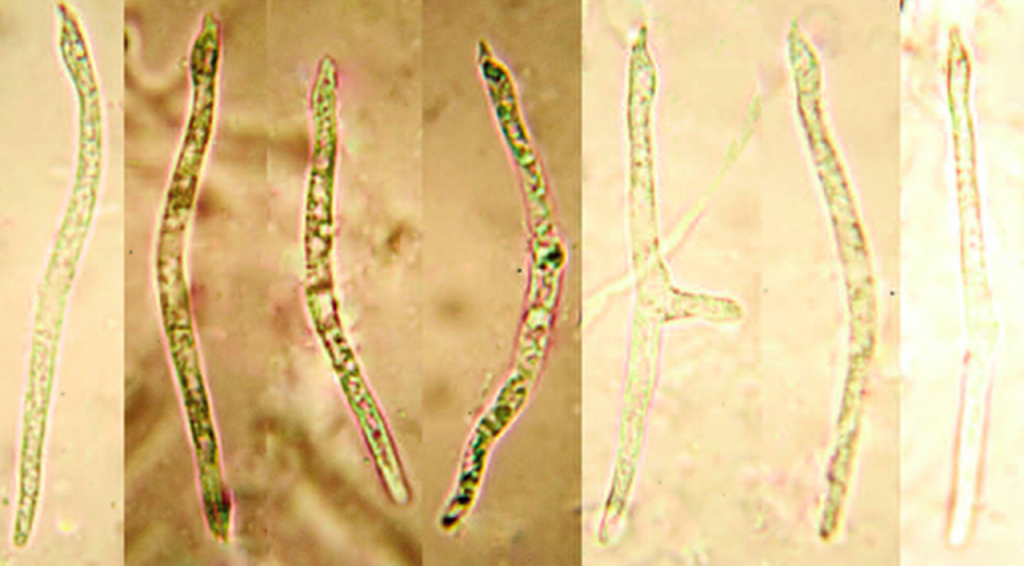 Microscopy image showing the unusual snake-like spores of Myxarium mirabile. Image © Nick Aplin