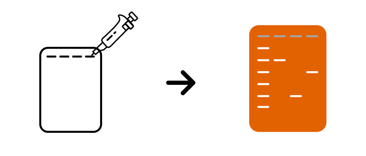 PCR workflow step 3: Visualise results by Gel Electrophoresis